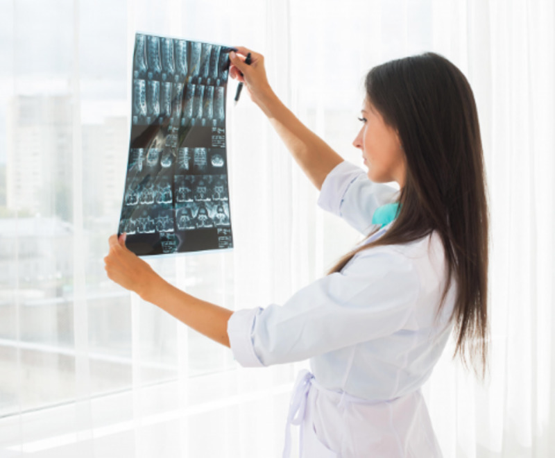 Болезнь Бехтерева